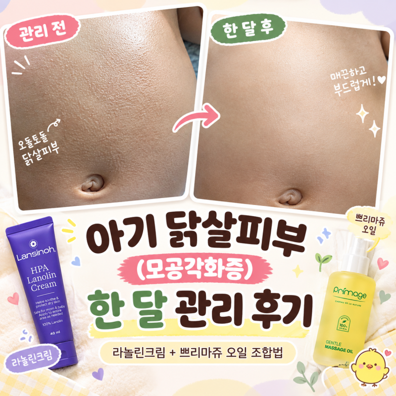 아기 닭살피부(모공각화증) 한 달 관리 후기 | 라놀린크림 + 쁘리마쥬 오일 조합법