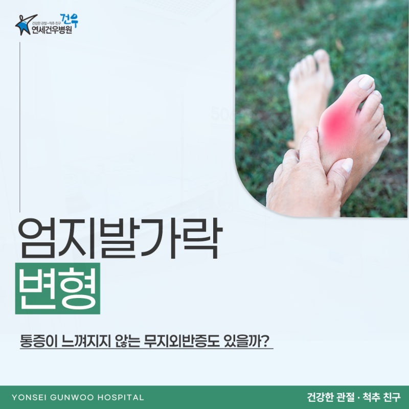 엄지발가락 변형 통증이 느껴지지 않는 무지외반증도 있을까?
