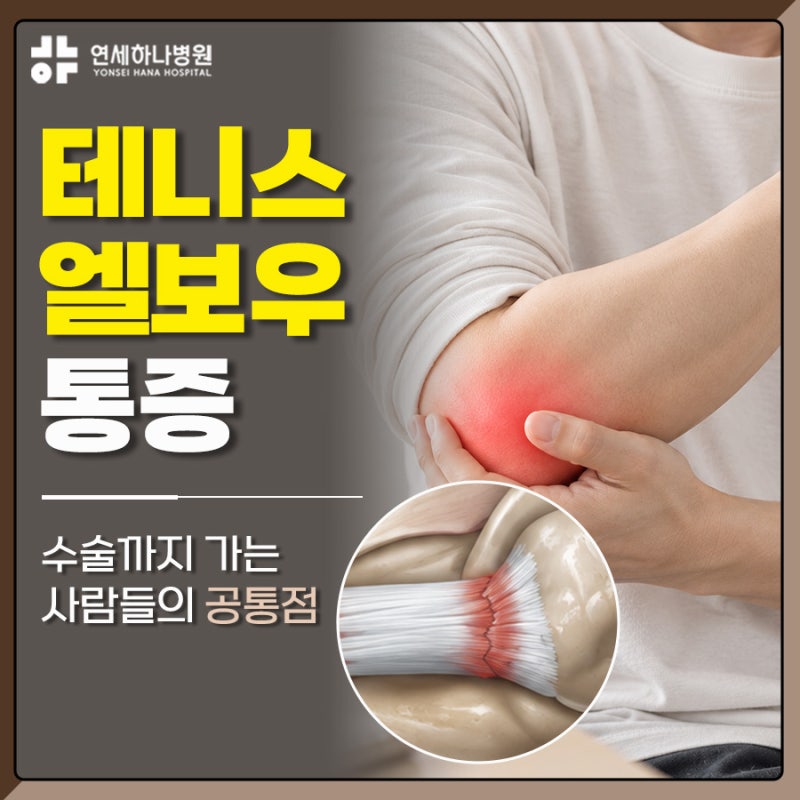 테니스엘보우통증, 외측상과염수술까지 가는 사람들의 공통점