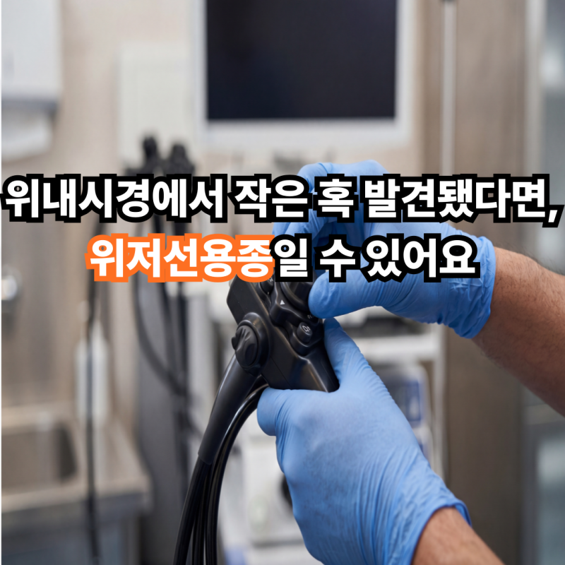 위내시경에서 작은 혹 발견됐다면, 위저선용종일 수 있어요