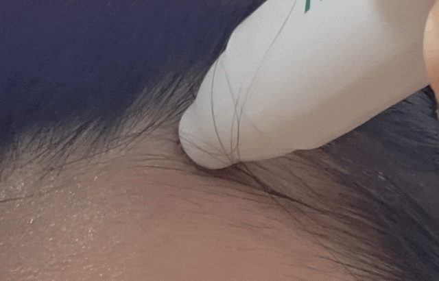 바이브랩 리바이브 테라피 두피앰플 후기｜머리 빠짐 때문에 샀는데, 끈적임 없는 시원한 사....