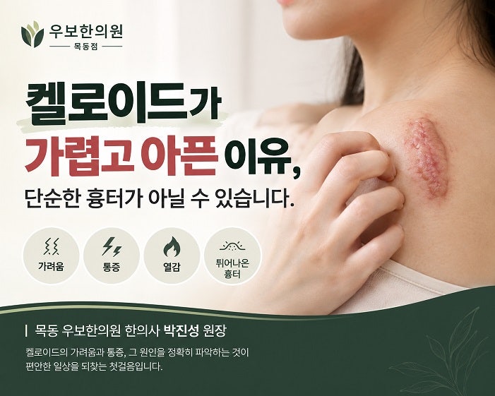 켈로이드가 가렵고 아픈 이유, 단순한 흉터가 아닐 수 있습니다