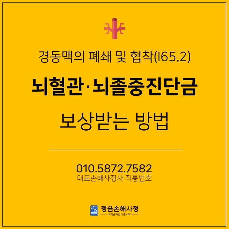 경동맥의 폐쇄 및 협착(질병코드: I65.2) 뇌혈관, 뇌졸중 진단금 수령을 위한 체크리스트!