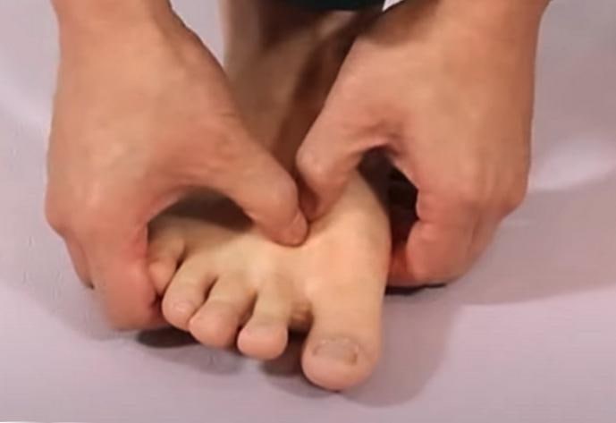 무지외반증 초기 신호를 집에서 자가로 확인하는 항목 정리까지