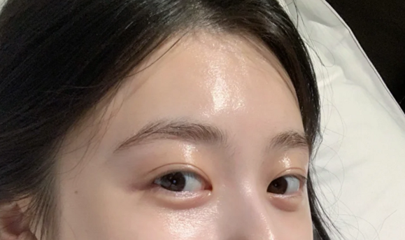 달바미스트세럼 n병째 다쓴템 리얼후기