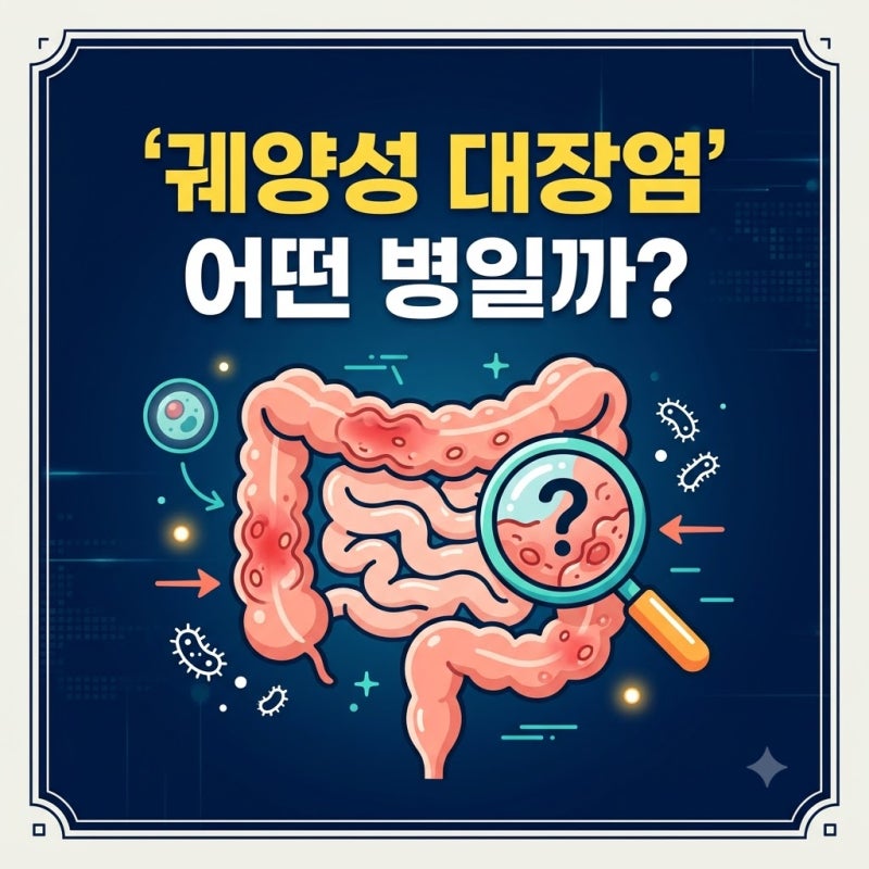 궤양성 대장염 증상부터 K51 질병코드·산정특례·실비보험까지 총정리