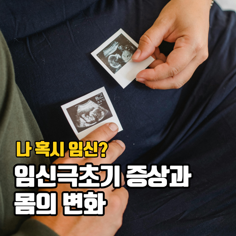 임신극초기 증상 4주 8주 미열 가슴통증 입덧 시작 시기 정리