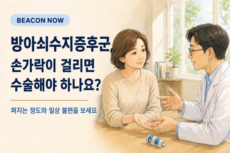 방아쇠수지증후군, 손가락이 걸리면 수술해야 하나요?