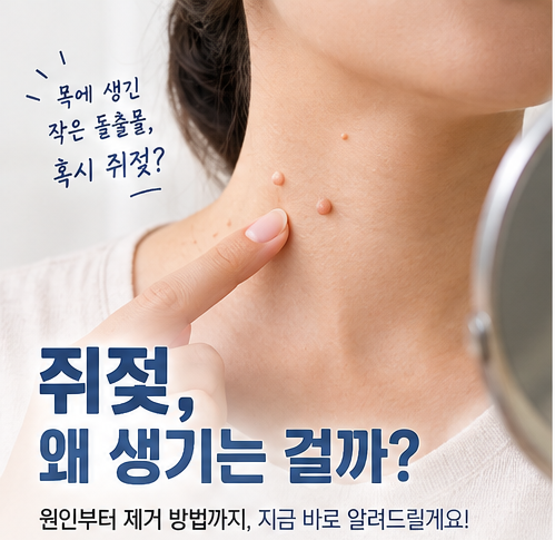 쥐젖 원인부터 제거 방법, 그리고 집에서 관리하는 꿀팁까지 총정리!