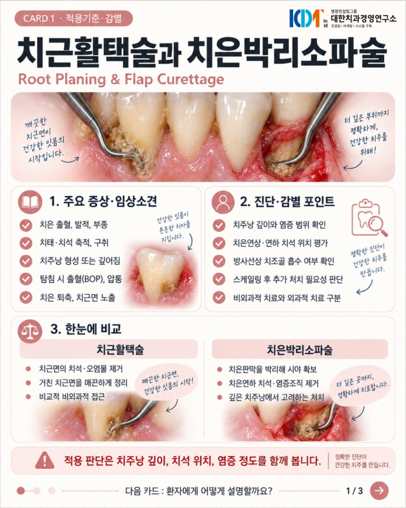 치근활택술과 치은박리소파술, 어떻게 구분할까요?