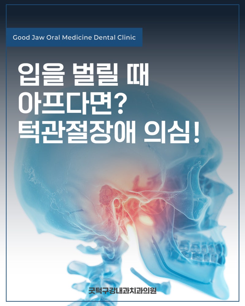 광주굿턱구강내과 턱관절장애로 인한 통증, 위치를 확인해야 합니다