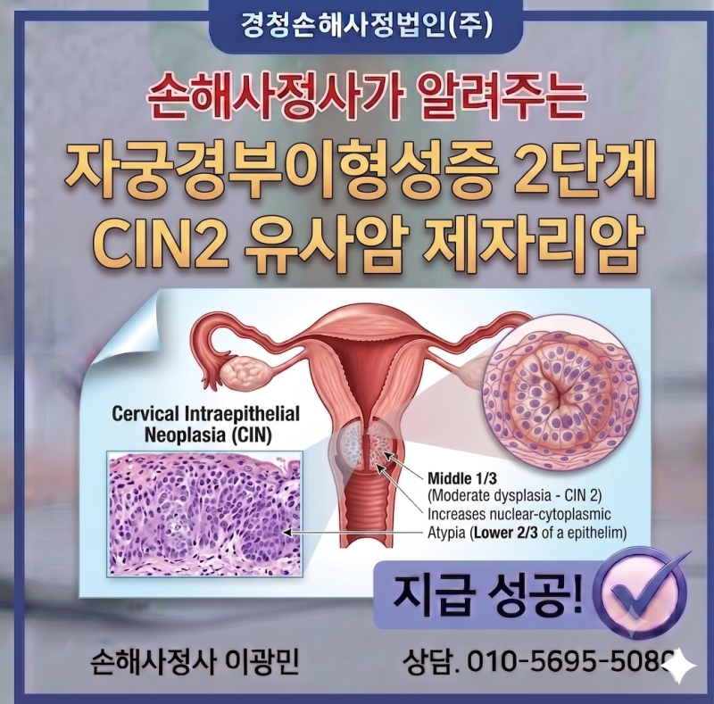 자궁경부이형성증 2단계 CIN2 유사암 제자리암 진단비 보상받는 법