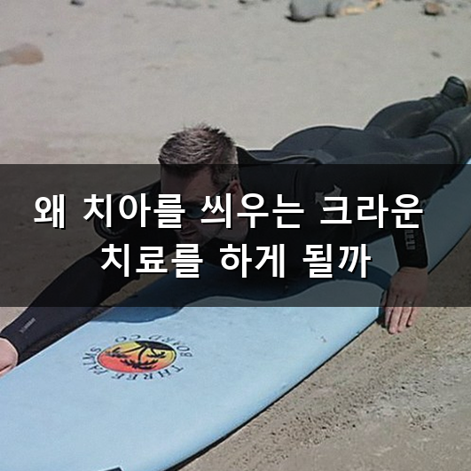 크라운 가격 치과 치료비 얼마나 차이날까?