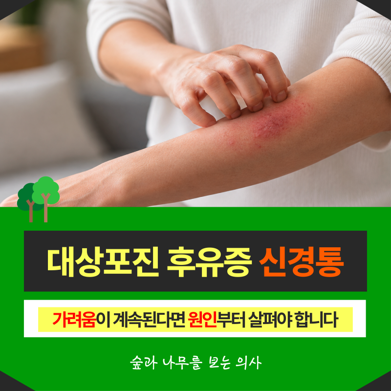 대상포진 후유증 신경통과 가려움이 계속된다면 원인부터 살펴야 합니다