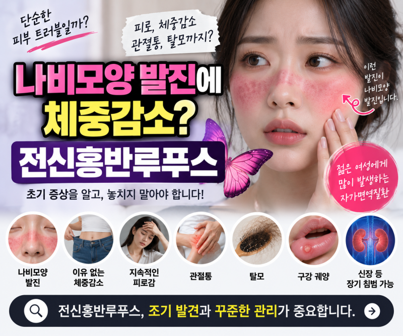 얼굴에 나비모양 발진과 체중감소가 함께 나타난다면? 전신홍반루푸스 알아보기