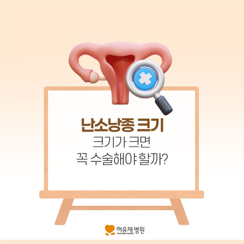 난소낭종 크기 크면 꼭 수술해야 할까?