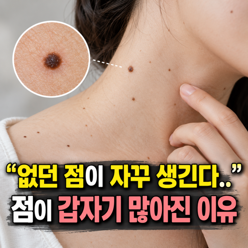 점이 생기는 이유 갑자기 많아진 점 원인과 제거 방법