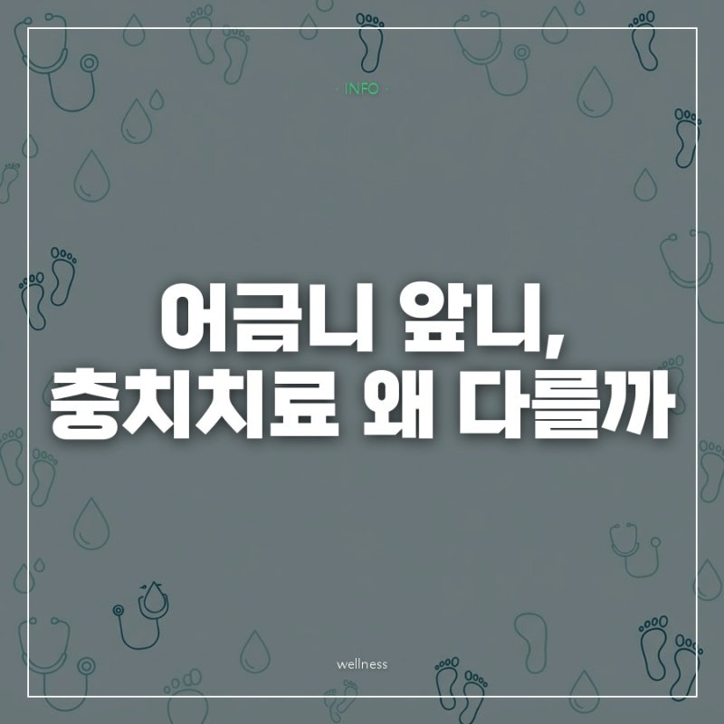 어금니는 크라운, 앞니는 레진이라는데 꼭 그렇게 치료해야 할까?