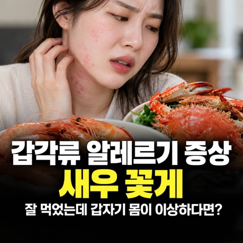 갑각류 알레르기 증상, 새우 꽃게 잘 먹었는데 갑자기 몸이 이상하다면?