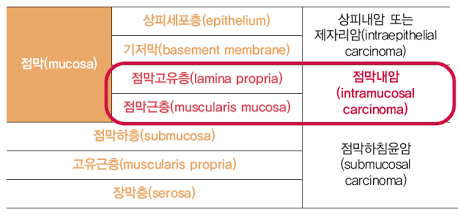 대장 용종 절제 후 "암 보험금" 제대로 받는 법: 대장점막내암 분쟁 완벽 정리