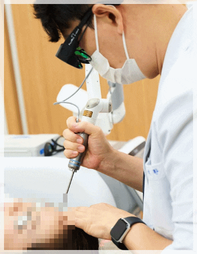 광주 편평사마귀 제거, 두가지 레이저를 사용하는 이유?