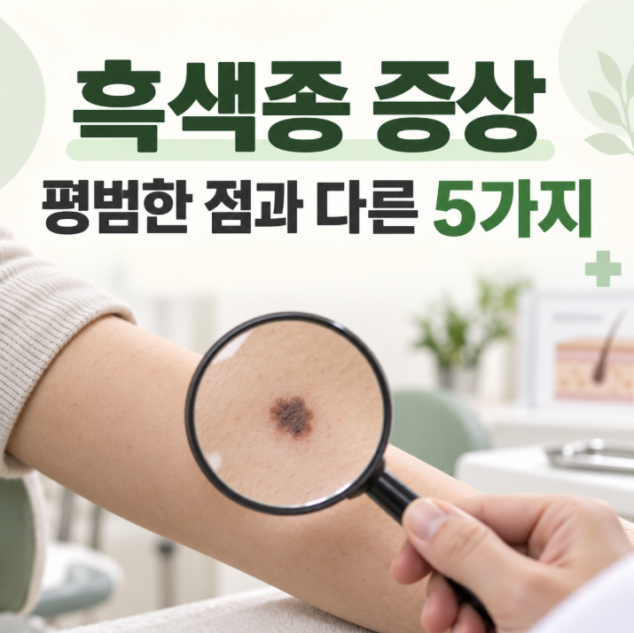 흑색종 증상, 평범한 점과 다른 특징 5가지