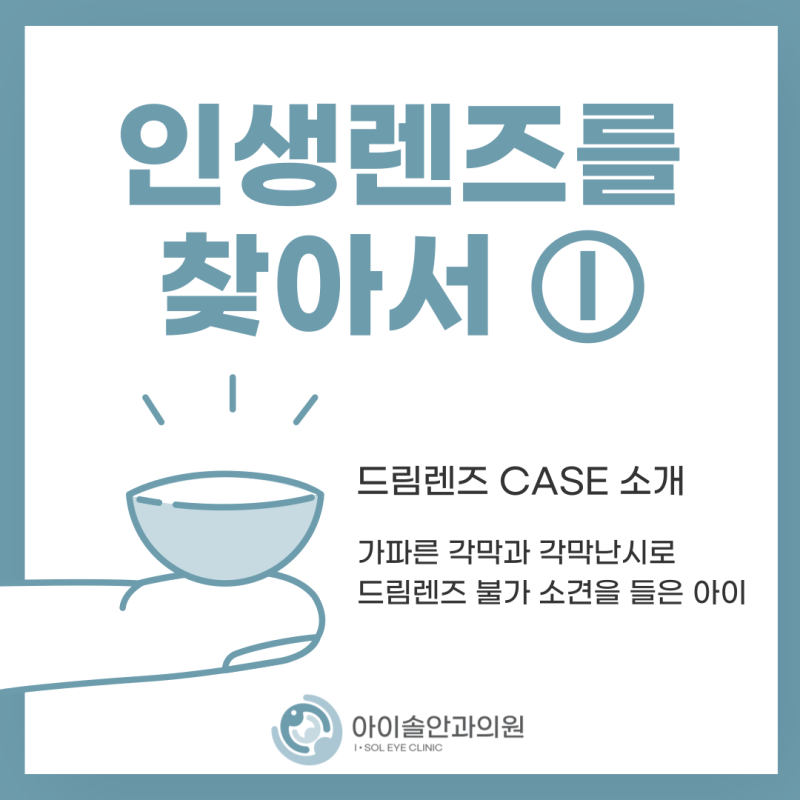 「인생렌즈를 찾아서 ①」 가파르고 난시가 있는 각막으로 드림렌즈 불가 소견을 들었던 초....