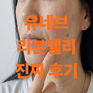 유네브 리본젤리 솔직 후기 내돈내산 (배송 효과 성분 부작용)
