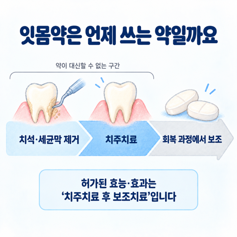 잇몸약만으로 잇몸병이 나을까요? 허가사항에 적힌 효능·효과와 역할