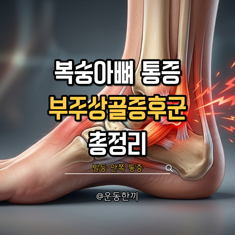 부주상골증후군 수술 증상 치료 방법 신발 깔창