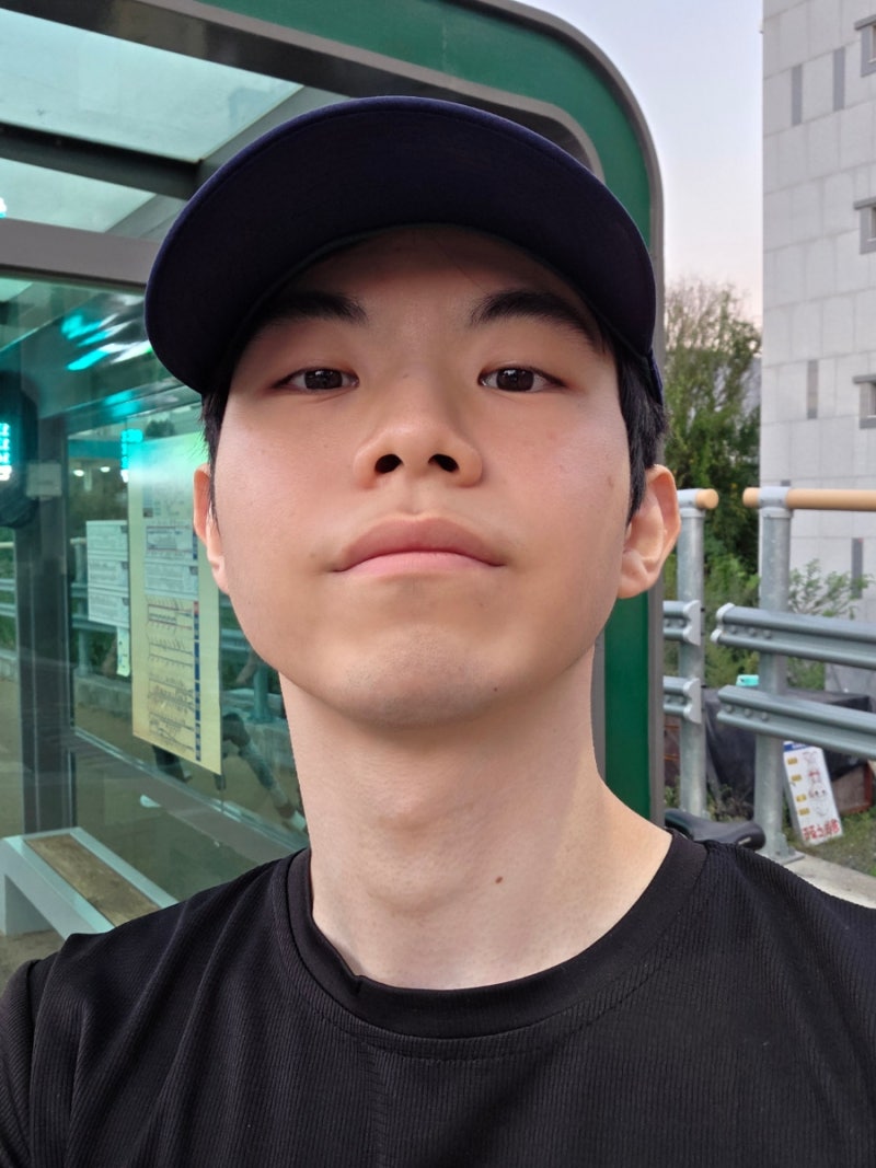 남자 레이저제모 1회차 후기
