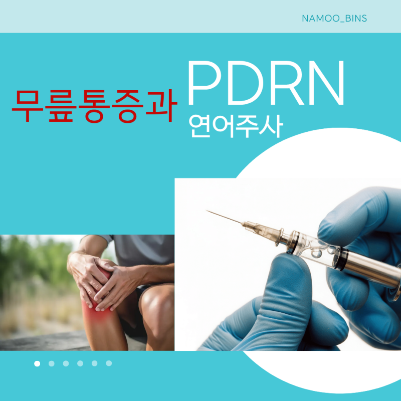[내돈내산/경험담] 무릎통증 끝! 연어 주사로 불리는 PDRN 주사 2회차 찐 후기와 의학적 원리 ....
