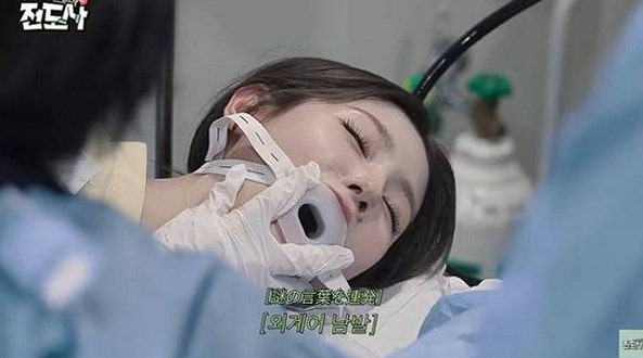 미연 "첫 수면 내시경 공개" 건강검진 영상 의료법 위반 신고, 병원 특정 가능했던 장면에 관....
