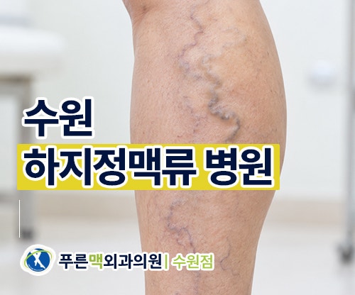 수원하지정맥류병원 종아리 실핏줄 원인, 치료방법 정리