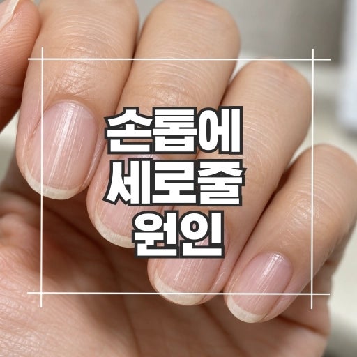 손톱에 세로줄 생기는 원인 7가지, 이유가 무엇일까?