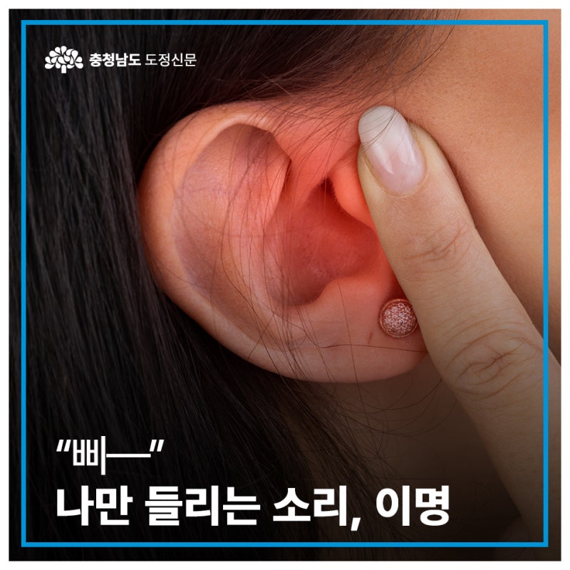 “삐—” 나만 들리는 소리, 이명