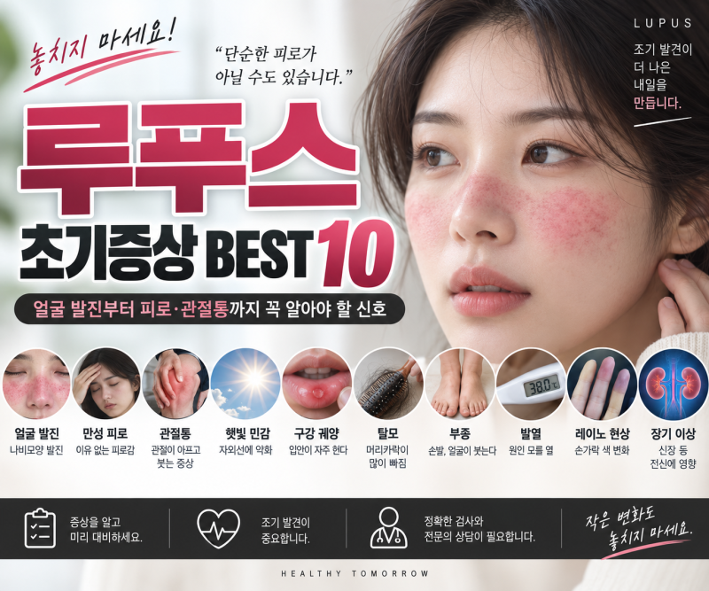 루푸스 초기증상 BEST 10, 얼굴 발진부터 피로·관절통까지 꼭 알아야 할 신호