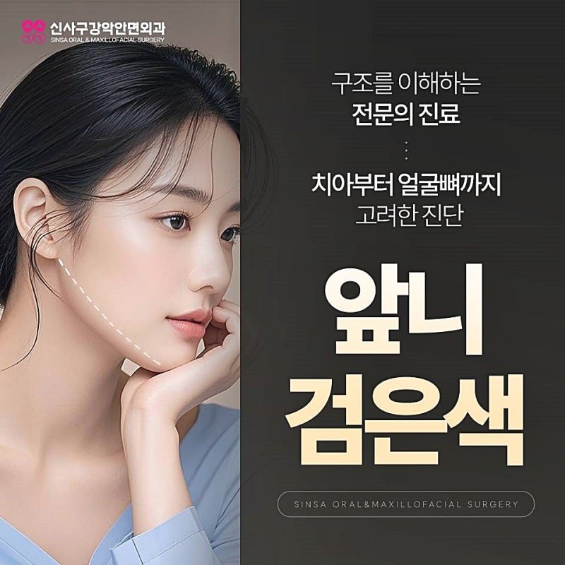 앞니 검은색으로 변했다면 충치일까? 원인과 치료 방법