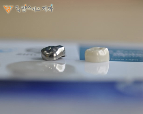 의정부소아치과 유치 크라운 치료 비용, 어떤 경우에 씌워야 할까요?