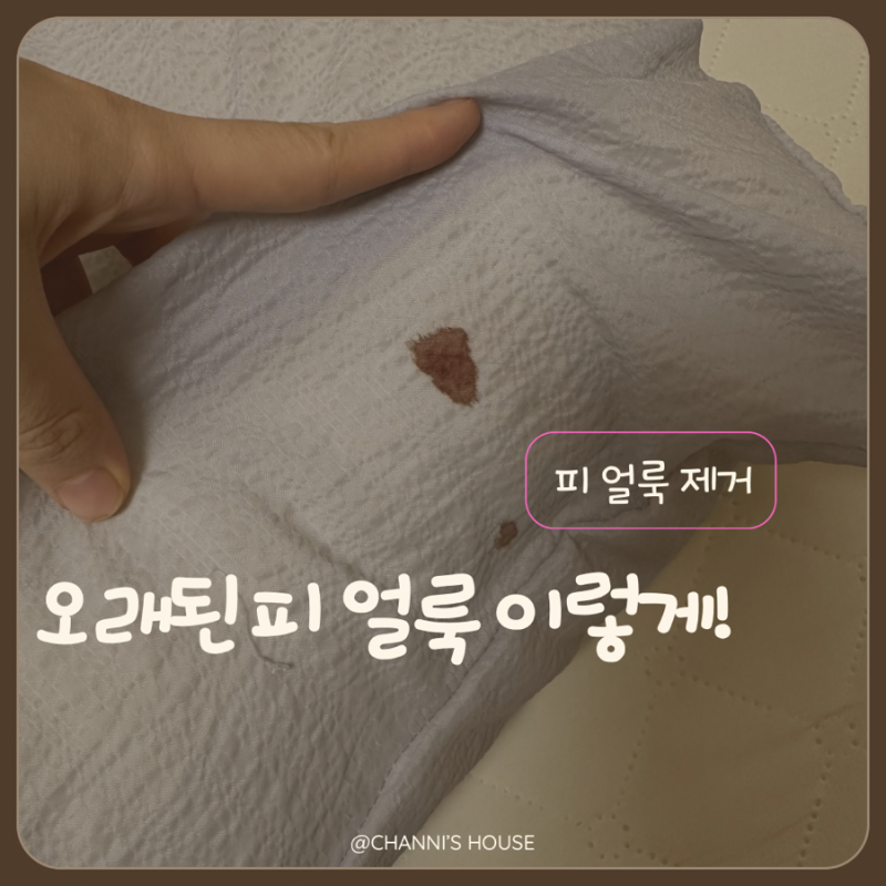 세탁했는데 그대로인 피 얼룩, 오래된 혈흔은 이렇게 해보세요