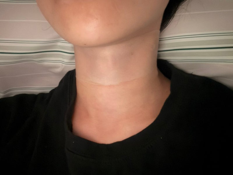 올킨스 넥패치 내돈내산 목주름 후기