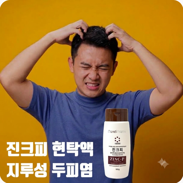 진크피현탁액, 지루성 두피염 약용샴푸, 피리티온아연 효과 사용법