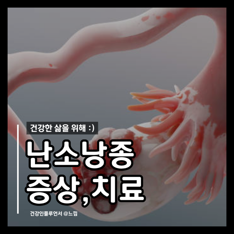 난소낭종 증상 통증 원인 수술