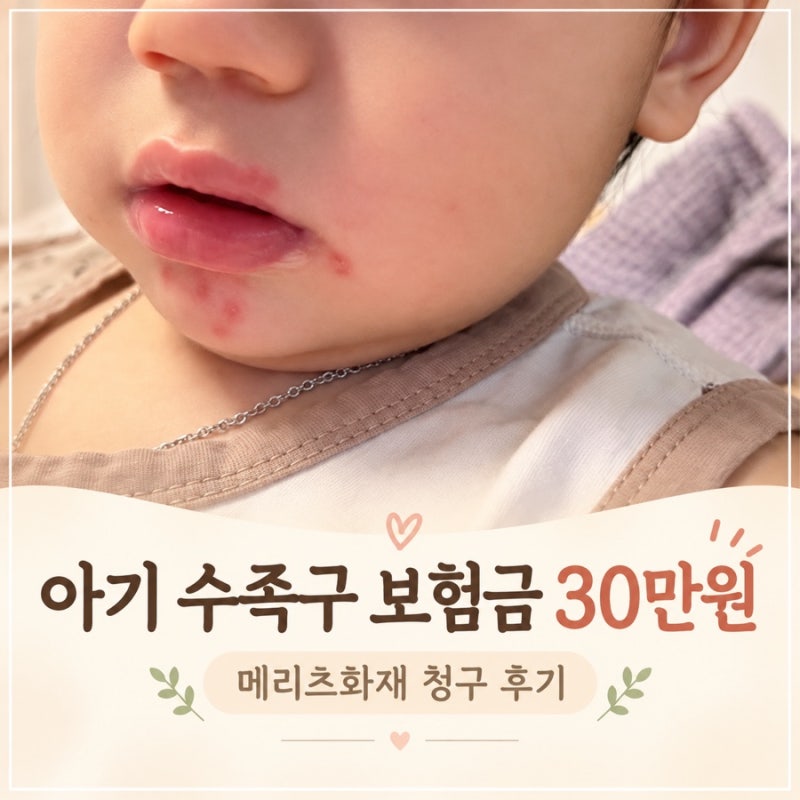 아기 수족구 보험금 청구 후기｜메리츠화재 수족구 진단비 30만원 지급