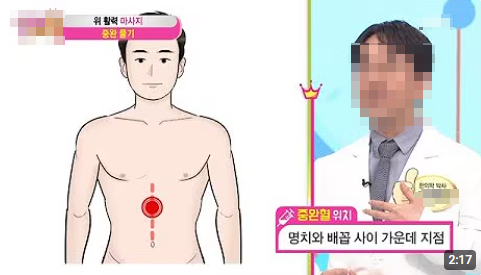 게실염 수술 대신 유산균 관리 입원 전 예방법 TOP3