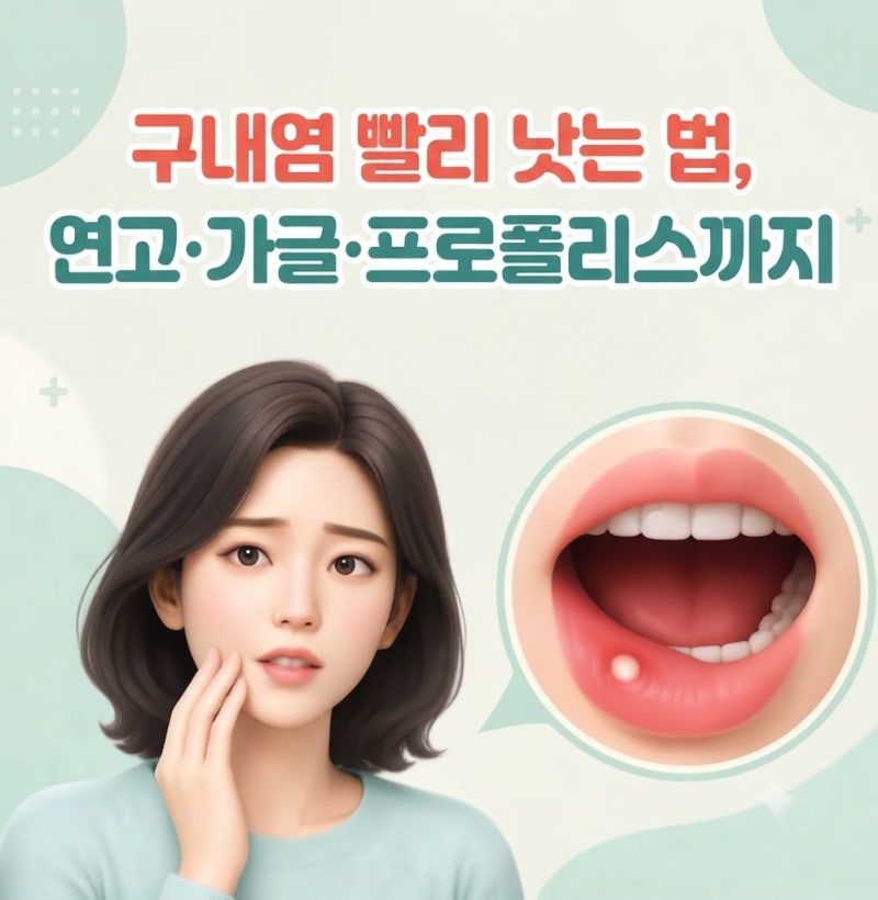 구내염 빨리 낫는 법, 연고·가글·프로폴리스까지