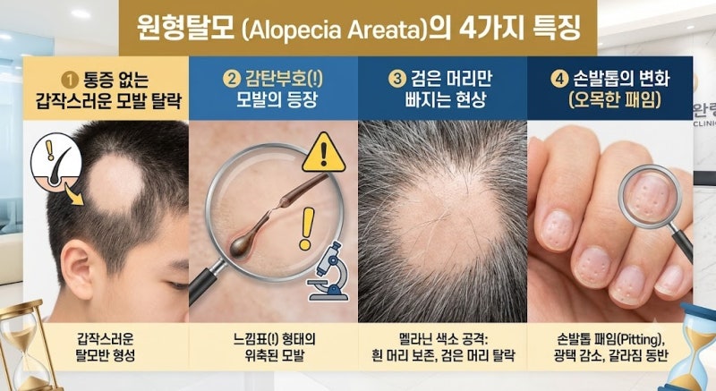[원형탈모 완전 정복] 동전 크기에서 전신까지: 진행 유형과 초기 자가진단법