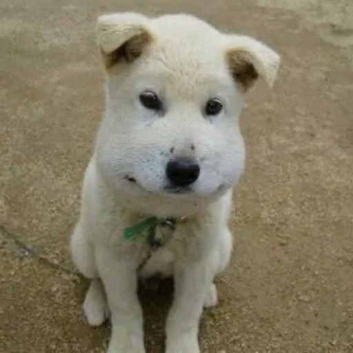 대학병원 양악수술 후기 퇴원 후 2주차 회복과정