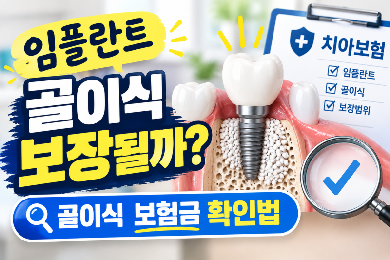 임플란트 했는데 보험금 받을 수 있다고? 오래된 생명보험 수술비 특약 확인