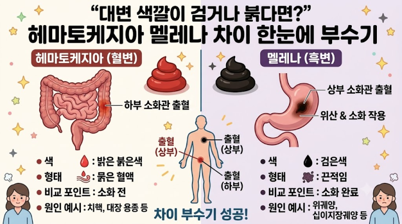"대변 색깔이 검거나 붉다면?" 헤마토케지아 멜레나 차이 한눈에 부수기